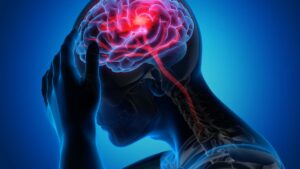 Brain Stroke Symptoms : ब्रेन स्ट्रोकच्या या लक्षणांकडे चुकूनही दुर्लक्ष करू नका; वेळेत उपचार घेतल्यास वाचू शकतो जीव