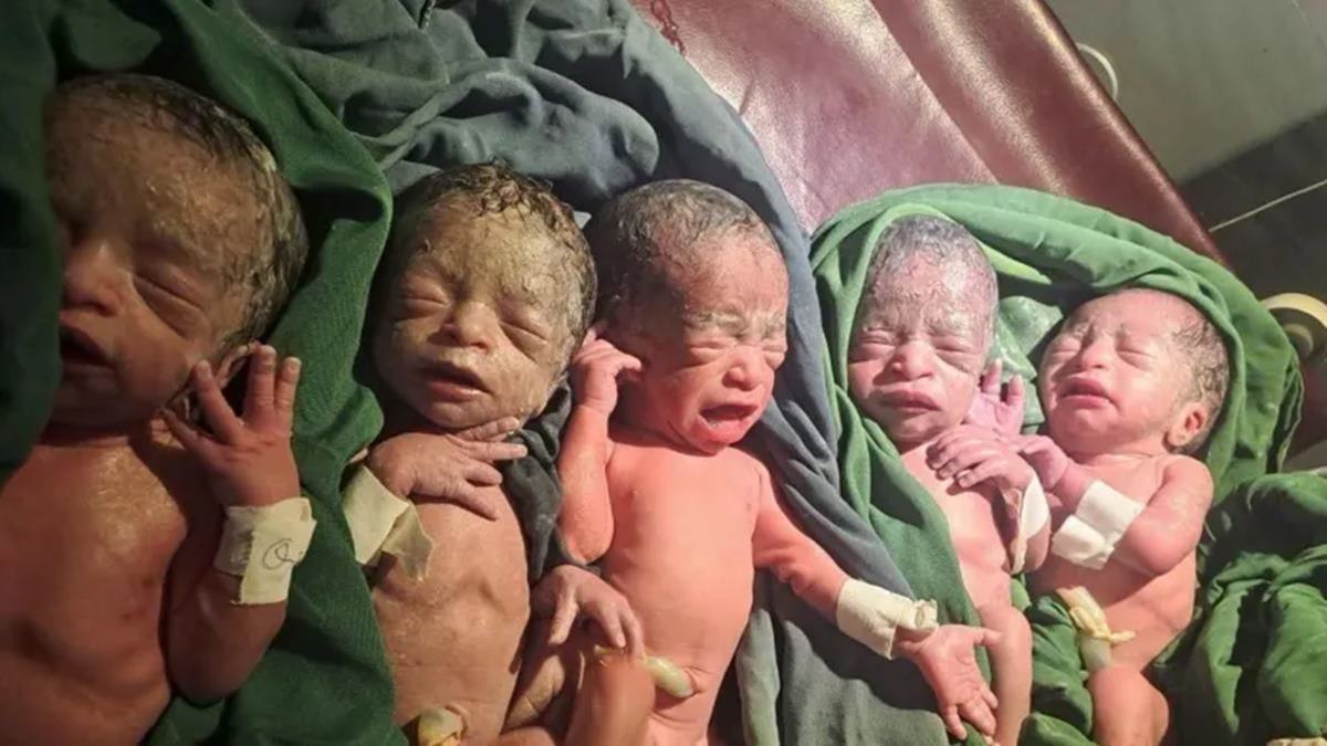 Rare Quintuplets Birth Ethiopia