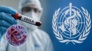 Ebola Alert: भारतात इबोलाचा शिरकाव? आफ्रिकेतून बंगळुरूत आलेली तरुणी क्वारंटाईन; आरोग्य यंत्रणा हाय अलर्टवर