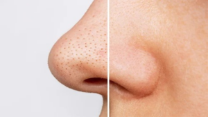 Beauty Tips